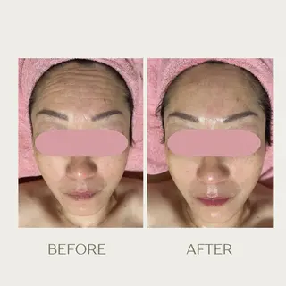 ピーリングケア 🤍moekoのその他イメージ