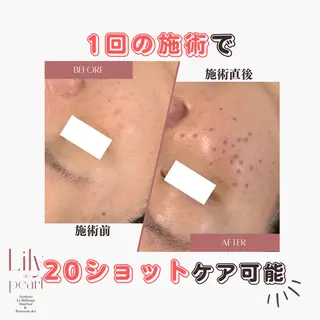 最新シミケアLily de pearlのエステ・リラクイメージ