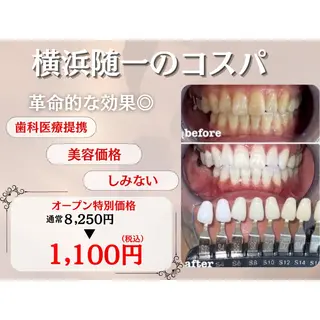 PureWhitening所属・ピュアホワイトニング 横浜店のエステ・リラクイメージ