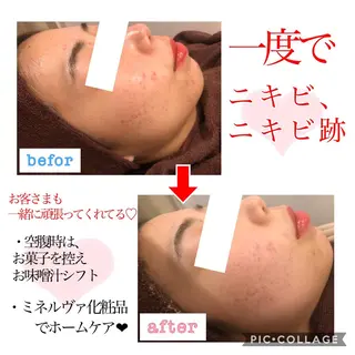 セミロング カラー パーマ ヘアアレンジ メンズ キッズ ネイル マツエク・マツパ 金の糸脱毛 産毛ケア専門のエステ・リラクイメージ