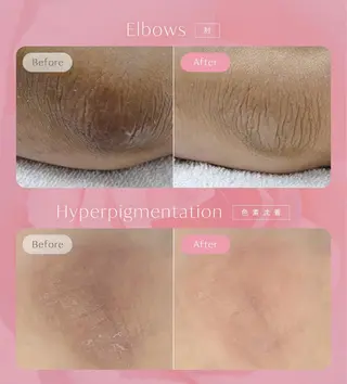 KIRAN 山﨑のエステ・リラクイメージ