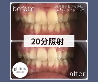 マツエク・マツパ ホワイトニング専門店 glitterのその他イメージ