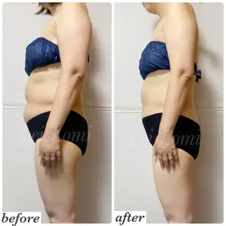 痩身＆ヘッド 長倉絵美のエステ・リラクイメージ