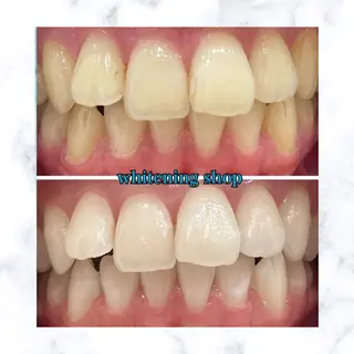 ホワイトニングショップ時津店所属・ホワイトニング ショップ長崎時津店のその他イメージ