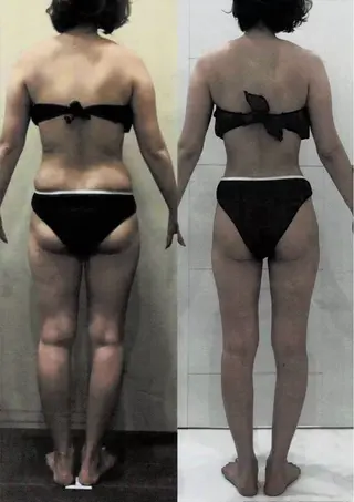 トータルビューティー リアラココ　上田仁美のその他イメージ