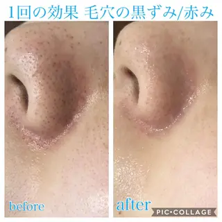 ロング カラー パーマ ヘアアレンジ キッズ ネイル マツエク・マツパ EnsorClair 代表　野口真央のエステ・リラクイメージ