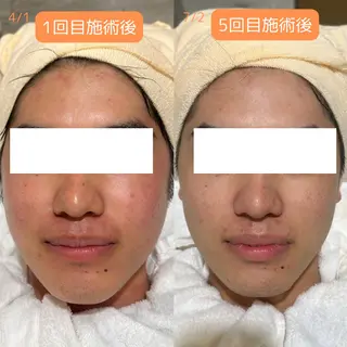 メンズ pansy フェイシャルエステのエステ・リラクイメージ