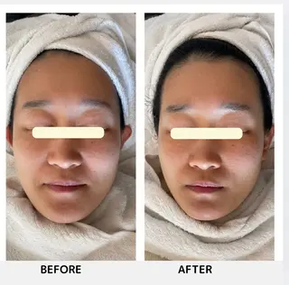 Yoshino Erinaのエステ・リラクイメージ