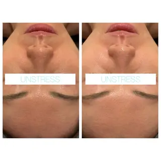 小顔コルギ ☆表参道/外苑前のエステ・リラクイメージ