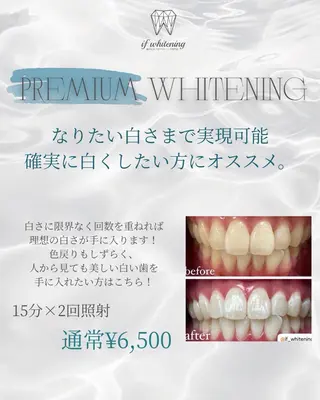 if_whitening柏原店所属・棟久 香澄のその他イメージ