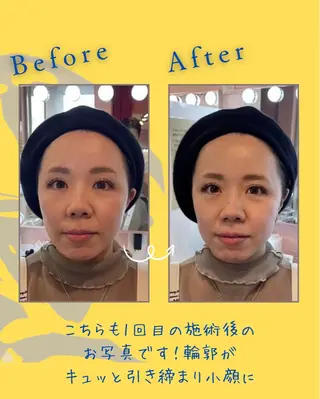 ヘアサロンLISALISA所属・セルフ脱毛・光エステ LISALISAのエステ・リラクイメージ