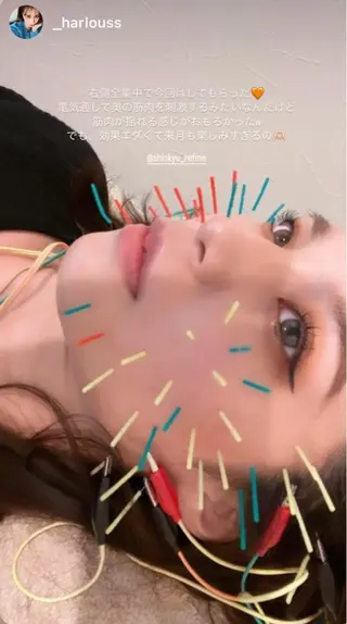 鍼灸 Refineのその他イメージ