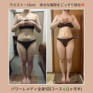 《本気痩せ×疲労改善 》  BILOOPのエステ・リラクイメージ