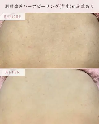 肌質改善専門サロン Bellmi/心斎橋のエステ・リラクイメージ