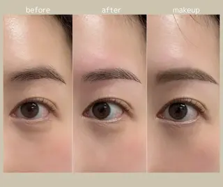 アイブロウ 眠りの森/脱毛眉毛/ マッサージ/RINAのエステ・リラクイメージ