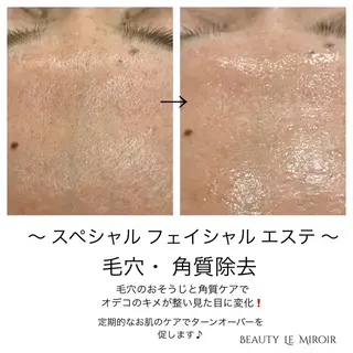 ビューティー ミロワールのエステ・リラクイメージ