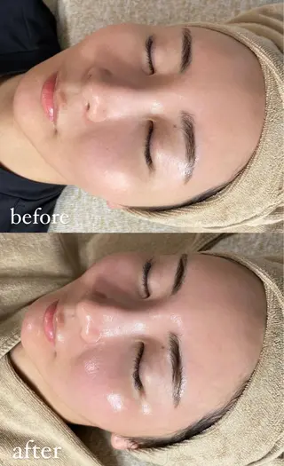 エステサロン Mi-mi.iのエステ・リラクイメージ