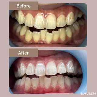 LAVISH nail salonのヘアスタイル