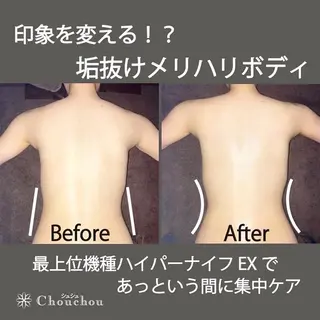 メンズ 痩身・小顔・美肌専門 Chou chouのエステ・リラクイメージ