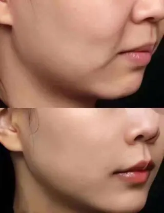 アイブロウ aliaハーブ水光店 エステティシャン募集のエステ・リラクイメージ