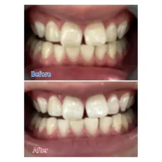 Ｍ渋谷 ホワイトニングのエステ・リラクイメージ