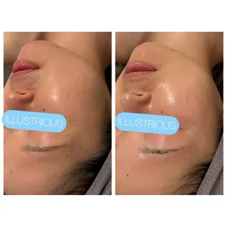 小顔コルギ ☆表参道/外苑前のエステ・リラクイメージ