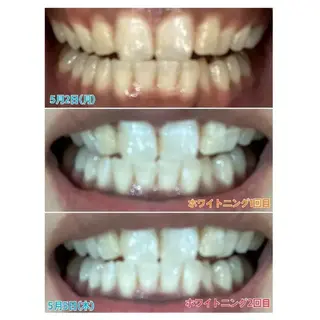 M渋谷 ホワイトニングのエステ・リラクイメージ