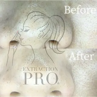 【まつ毛パーマ/眉毛/毛穴ケア】Anoa'n所属・Anoa'n北千住 畠山菜緒のマツエク・マツパデザイン