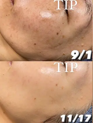 パーソナルスキンケア 🦋APRI🅿️有のエステ・リラクイメージ