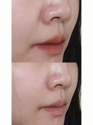 マツエク・マツパ aliaハーブ水光店 エステティシャン募集のエステ・リラクイメージ