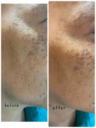 メナード　茜部野瀬 長谷部のエステ・リラクイメージ