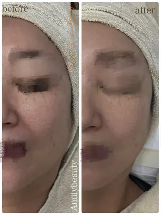 Amily beauty 毛利のエステ・リラクイメージ