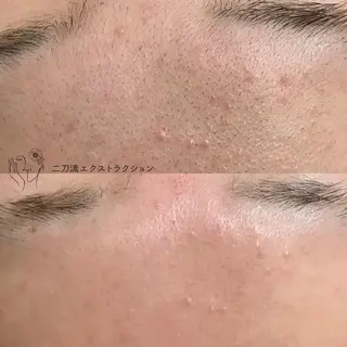 プライベートサロン emma【エマ】の眉毛・アイブロウイメージ