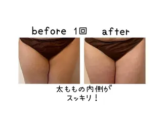 癒し腸もみサロン シャユーム　ゆきなのその他イメージ