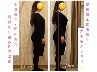 小顔矯正 natsuのエステ・リラクイメージ