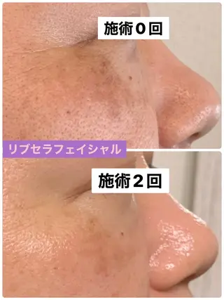 プライベートサロン プリュネルのエステ・リラクイメージ