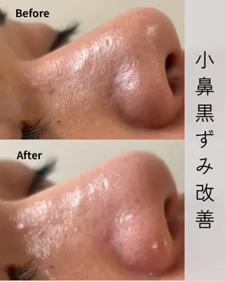 Novelle所属・nozomi.m🌷 narisのエステ・リラクイメージ