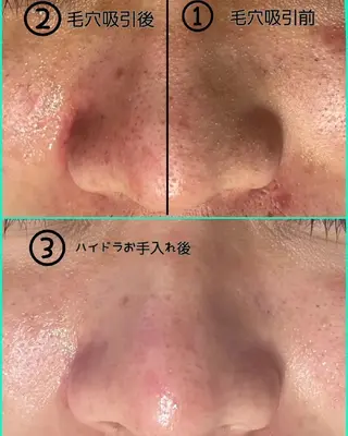 メンズ Lino SALONのエステ・リラクイメージ