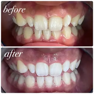 LIBRA 天王寺店所属・セルフホワイトニング リブラ天王寺店のその他イメージ