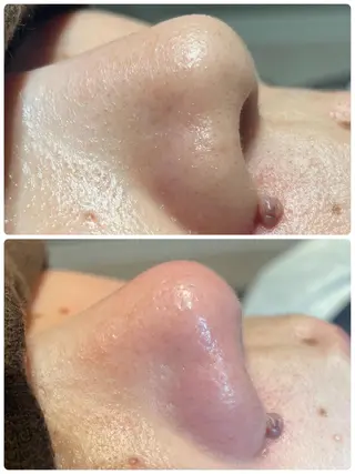 松下 千恵のネイルデザイン