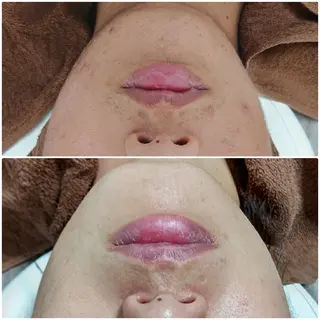 メンズ Iryアイリー所属・Iry アイリーのエステ・リラクイメージ