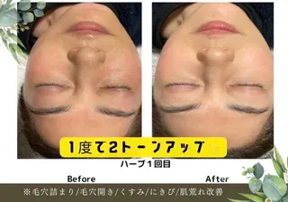 南森町・肌質改善 BELMIMARのエステ・リラクイメージ