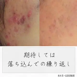 ニキビ経験者が施術 する専門サロン🌻のエステ・リラクイメージ