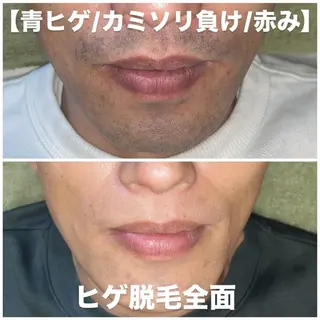 メンズ ビューティーサロン リノアのエステ・リラクイメージ