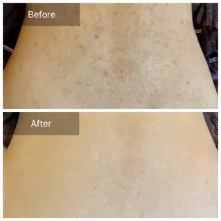 Flourb所属・ハーブピーリング専門 サロンFlourbのエステ・リラクイメージ