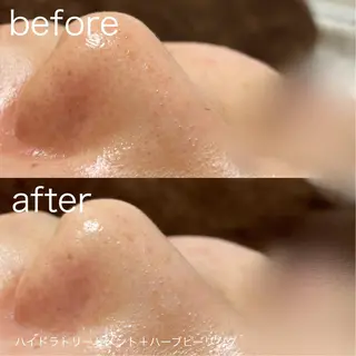 lulularico Yuのエステ・リラクイメージ