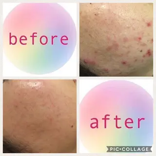 ミディアム カラー パーマ ヘアアレンジ メンズ キッズ ネイル マツエク・マツパ ニキビ・肌質改善専門 ♡人生が変わるサロンのエステ・リラクイメージ