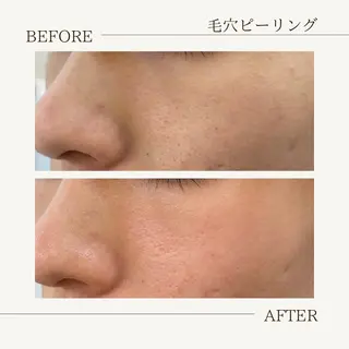 肌育成サロン ♡ RISAのエステ・リラクイメージ