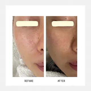 Yoshino Erinaのエステ・リラクイメージ