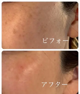 バスト美肌小顔専門 Mimpi【ミンピ】のエステ・リラクイメージ